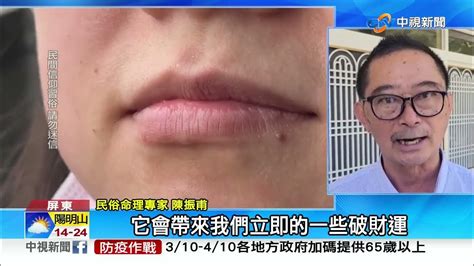 破財痣|窮鬼都有這4顆「破財痣」 男人這處長痣恐被仙人跳